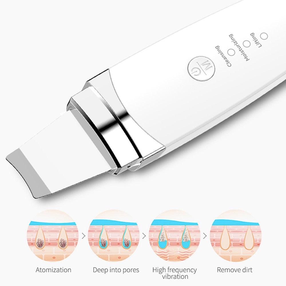 Ultrasonic Skin Blackhead Spatula - Siren Beauty